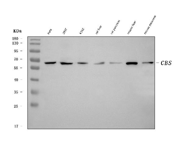 1 - Anti-CBS Antibody Picoband™ (monoclonal, 5B5D7) ABO16606