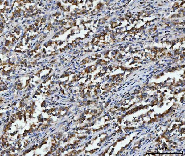 2 - Anti-Aconitase 2 Antibody Picoband™ (monoclonal, 4C12D1) ABO16607