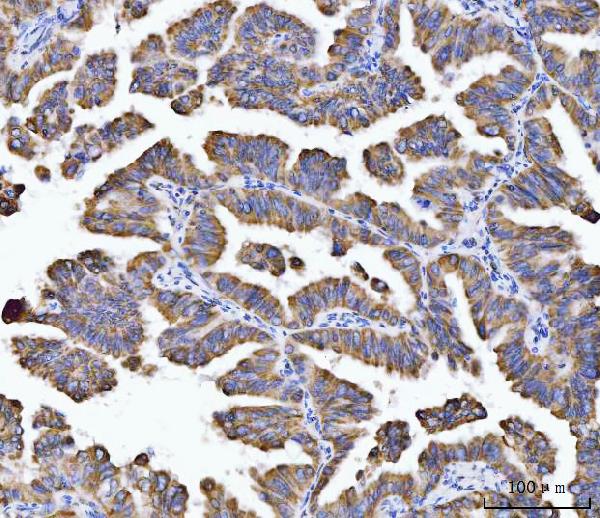 2 - Anti-Aconitase 2 Antibody Picoband™ (monoclonal, 4C12D1) ABO16607