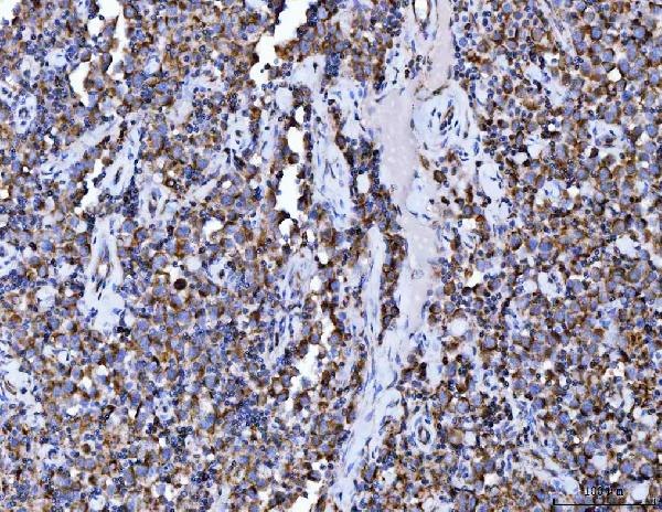 2 - Anti-Aconitase 2 Antibody Picoband™ (monoclonal, 4C12D1) ABO16607
