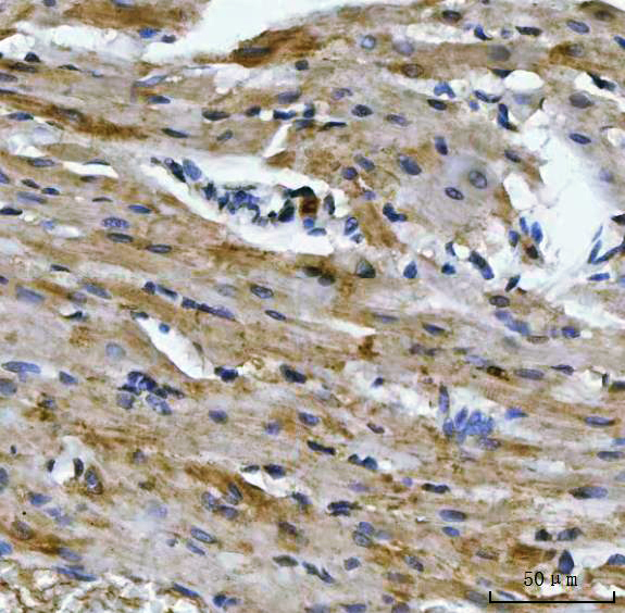 2 - Anti-Aconitase 2 Antibody Picoband™ (monoclonal, 4C12D1) ABO16607