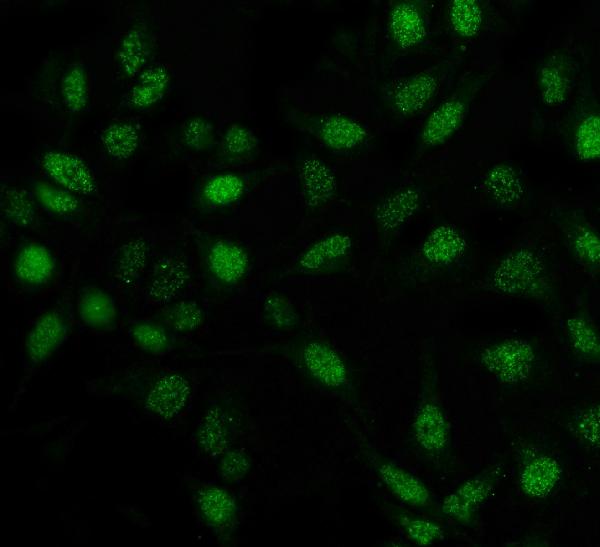 3 - Anti-Pin1 Antibody Picoband™ (monoclonal, 5E5) ABO16609