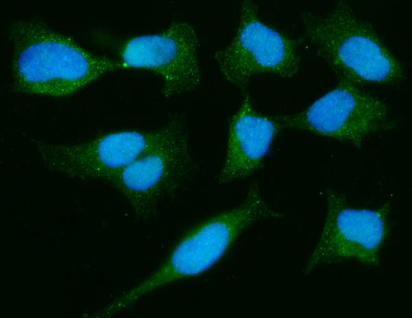 3 - Anti-PARK7/DJ1 Antibody Picoband™ (monoclonal, 4B10) ABO16610