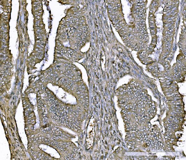2 - Anti-PARK7/DJ1 Antibody Picoband™ (monoclonal, 4B10) ABO16610