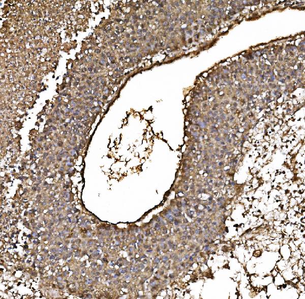 2 - Anti-PARK7/DJ1 Antibody Picoband™ (monoclonal, 4B10) ABO16610