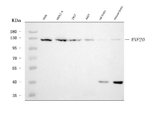 1 - Anti-RNF20 Antibody Picoband™ (monoclonal, 3C6E2) ABO16615
