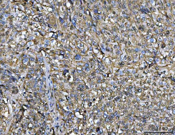 2 - Anti-Annexin A1/ANXA1 Antibody Picoband™ (monoclonal, 6B7F8) ABO16616