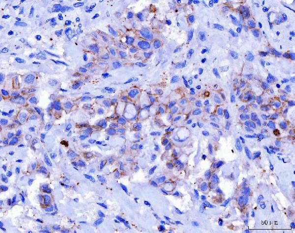 2 - Anti-Desmoglein 2/DSG2 Antibody Picoband™ (monoclonal, 2B4D1) ABO16617