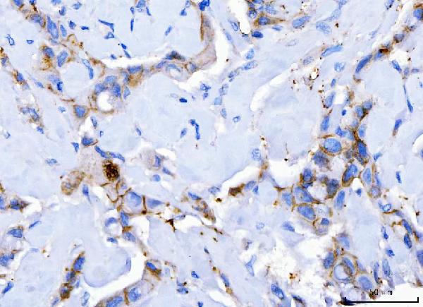 2 - Anti-Desmoglein 2/DSG2 Antibody Picoband™ (monoclonal, 2B4D1) ABO16617
