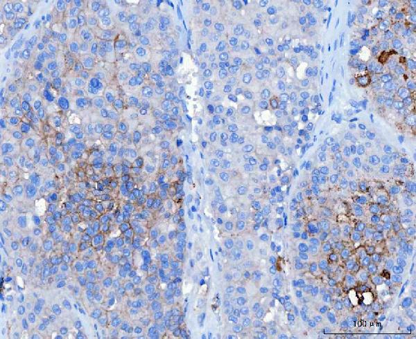2 - Anti-Desmoglein 2/DSG2 Antibody Picoband™ (monoclonal, 2B4D1) ABO16617