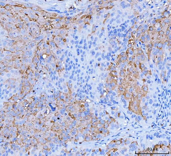 2 - Anti-Desmoglein 2/DSG2 Antibody Picoband™ (monoclonal, 2B4D1) ABO16617