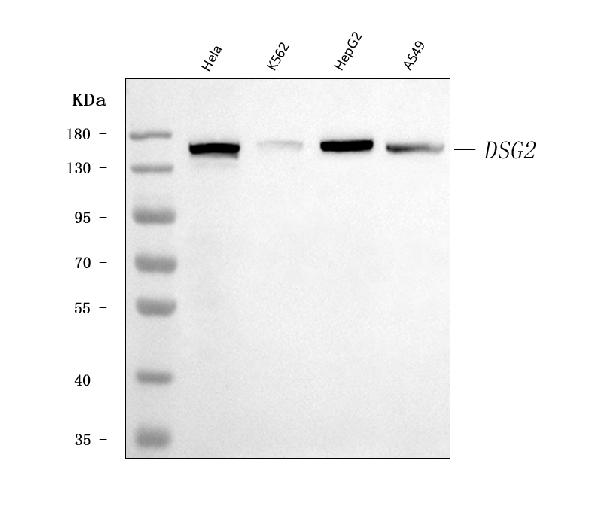 1 - Anti-Desmoglein 2/DSG2 Antibody Picoband™ (monoclonal, 2B4D1) ABO16617