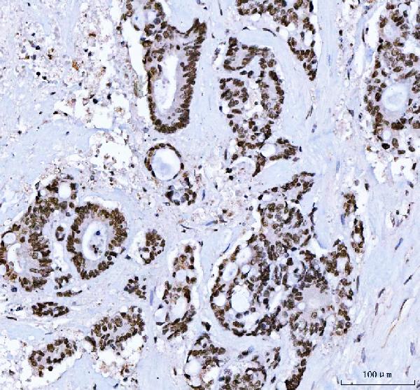 2 - Anti-CTBP2 Antibody Picoband™ (monoclonal, 7F3E1) ABO16619