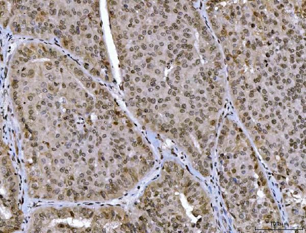 2 - Anti-CTBP2 Antibody Picoband™ (monoclonal, 7F3E1) ABO16619