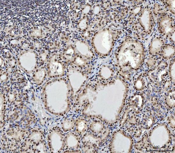 2 - Anti-CTBP2 Antibody Picoband™ (monoclonal, 7F3E1) ABO16619