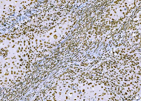 2 - Anti-CTBP2 Antibody Picoband™ (monoclonal, 7F3E1) ABO16619