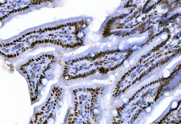 2 - Anti-CTBP2 Antibody Picoband™ (monoclonal, 7F3E1) ABO16619