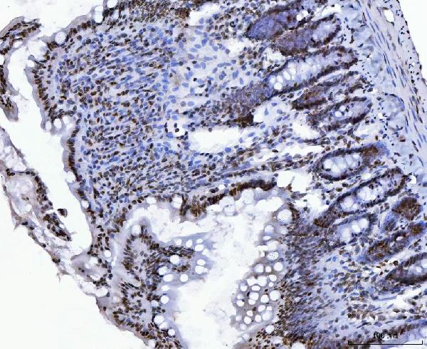 2 - Anti-CTBP2 Antibody Picoband™ (monoclonal, 7F3E1) ABO16619