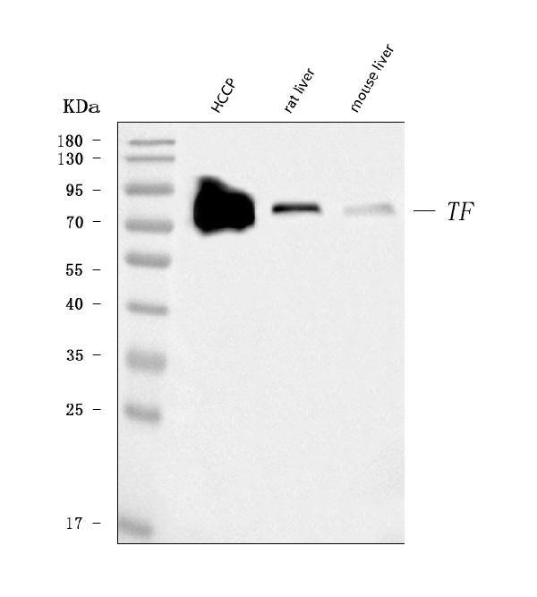 1 - Anti-Transferrin/TF Antibody Picoband™ (monoclonal, 7I11B10) ABO16620