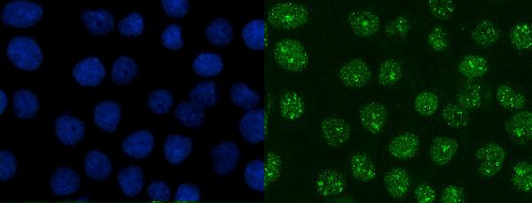 3 - Anti-XRCC1 Antibody Picoband™ (monoclonal, 10E10) ABO16621