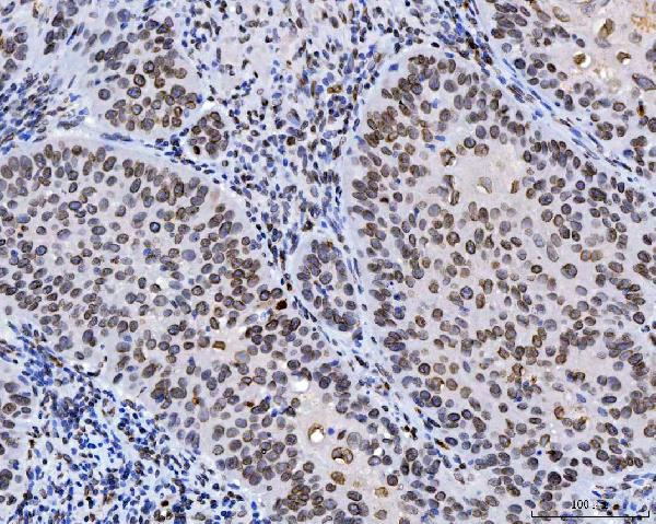 2 - Anti-Lamin A+C/LMNA Antibody Picoband™ (monoclonal, 5F3C12) ABO16622