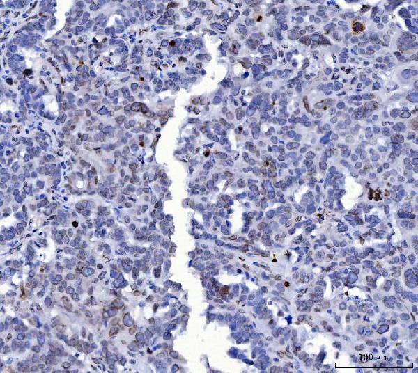 2 - Anti-Lamin A+C/LMNA Antibody Picoband™ (monoclonal, 5F3C12) ABO16622