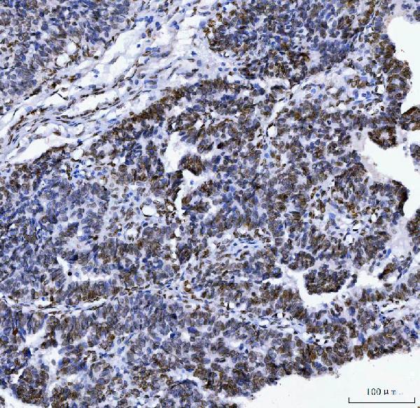 2 - Anti-Lamin A+C/LMNA Antibody Picoband™ (monoclonal, 5F3C12) ABO16622