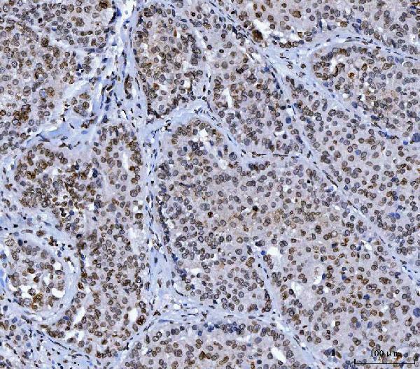 2 - Anti-Lamin A+C/LMNA Antibody Picoband™ (monoclonal, 5F3C12) ABO16622