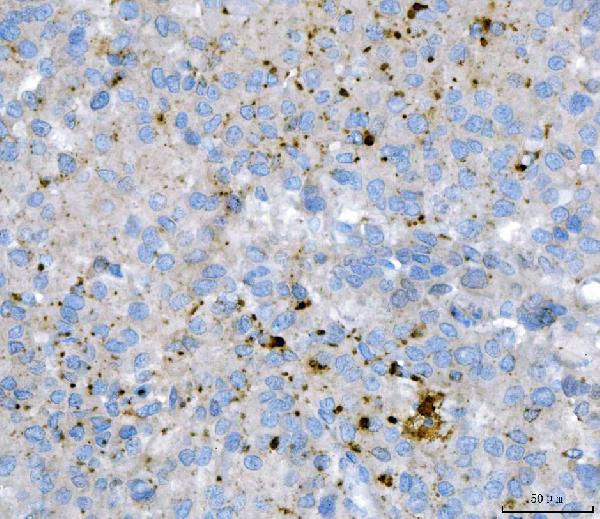 2 - Anti-KLHL12 Antibody Picoband™ (monoclonal, 2G11D1) ABO16625