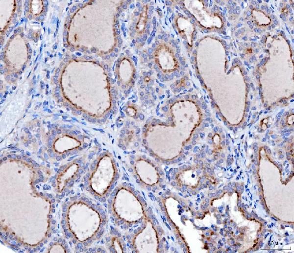 2 - Anti-KLHL12 Antibody Picoband™ (monoclonal, 2G11D1) ABO16625
