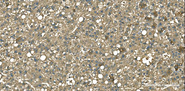 2 - Anti-Aspartate Aminotransferase/GOT1 Antibody Picoband™ (monoclonal, 6B3B4) ABO16626