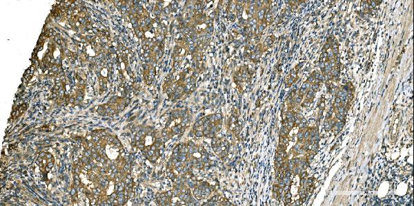 2 - Anti-Aspartate Aminotransferase/GOT1 Antibody Picoband™ (monoclonal, 6B3B4) ABO16626