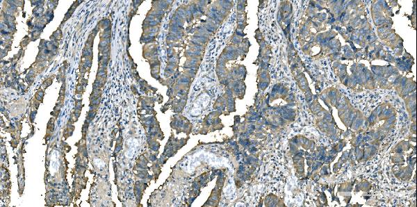 2 - Anti-Aspartate Aminotransferase/GOT1 Antibody Picoband™ (monoclonal, 6B3B4) ABO16626