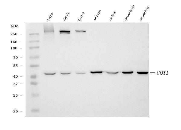 1 - Anti-Aspartate Aminotransferase/GOT1 Antibody Picoband™ (monoclonal, 6B3B4) ABO16626