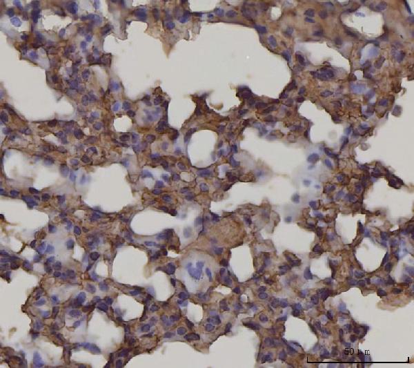 2 - Anti-RAGE/AGER Antibody Picoband™ (monoclonal, 5C6C1) ABO16627