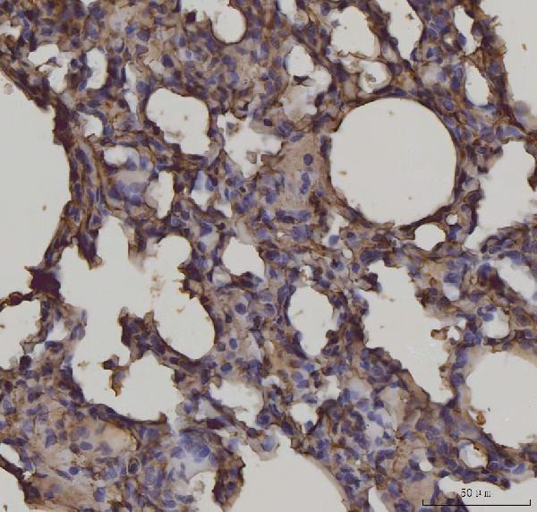 2 - Anti-RAGE/AGER Antibody Picoband™ (monoclonal, 5C6C1) ABO16627