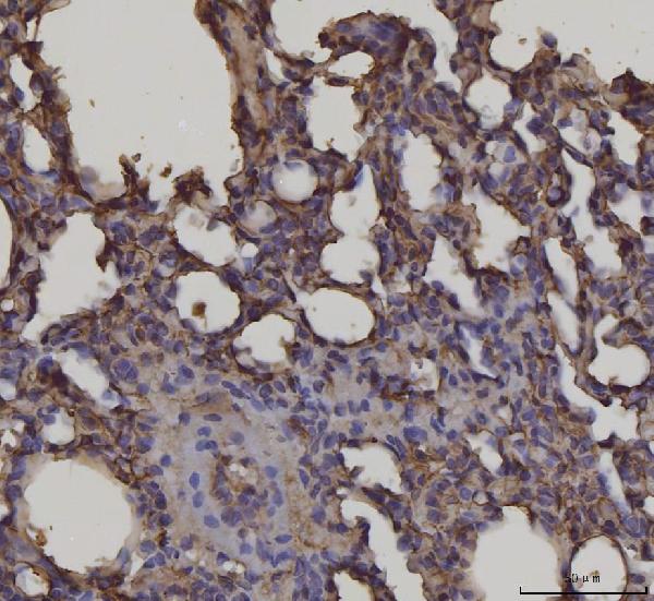 2 - Anti-RAGE/AGER Antibody Picoband™ (monoclonal, 5C6C1) ABO16627