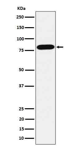 1 - Anti-ABCD1 / ALD Rabbit Monoclonal Antibody ABO16628