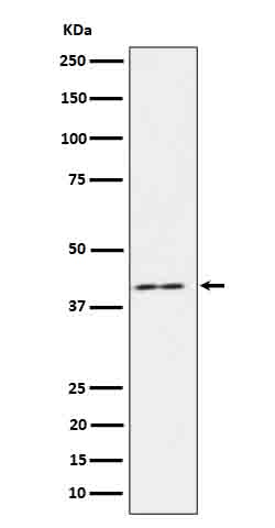 1 - Anti-IL18 binding protein Rabbit Monoclonal Antibody ABO16629