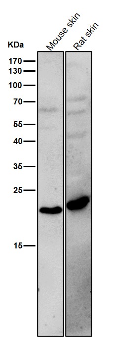 1 - Anti-BCL2L15 Rabbit Monoclonal Antibody ABO16630