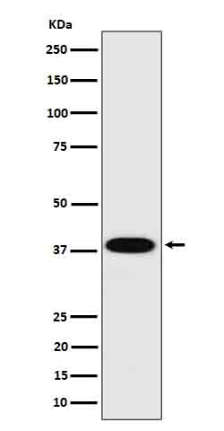 1 - Anti-Cathepsin H Rabbit Monoclonal Antibody ABO16634