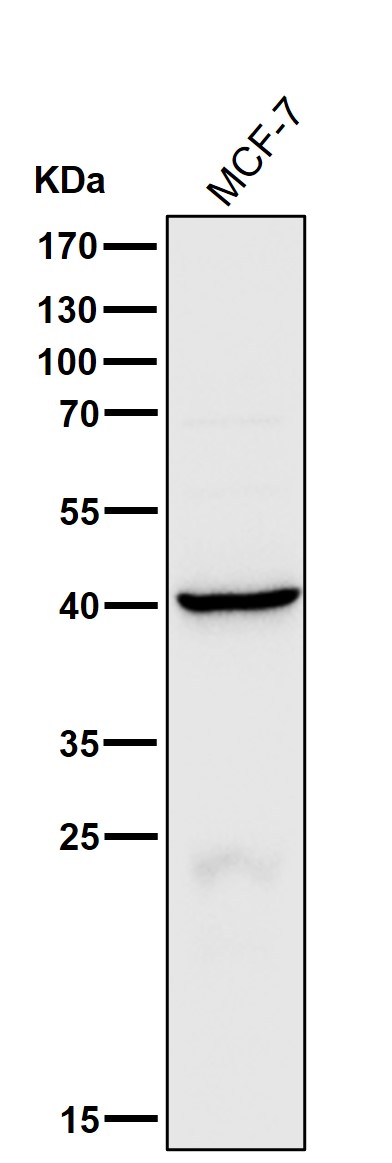 1 - Anti-Cathepsin H Rabbit Monoclonal Antibody ABO16634