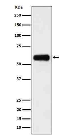 1 - Anti-CD116 Rabbit Monoclonal Antibody ABO16641