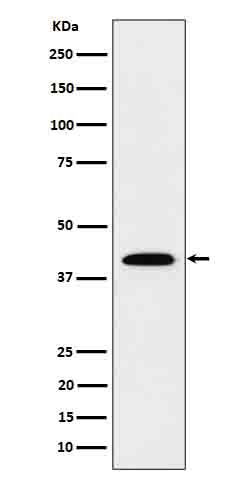 1 - Anti-IL12B Rabbit Monoclonal Antibody ABO16642