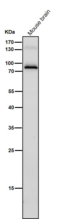 1 - Anti-IL12B Rabbit Monoclonal Antibody ABO16642