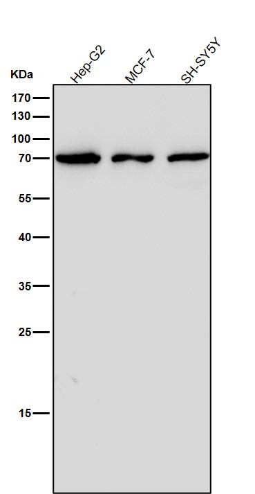 1 - Anti-IL12B Rabbit Monoclonal Antibody ABO16642
