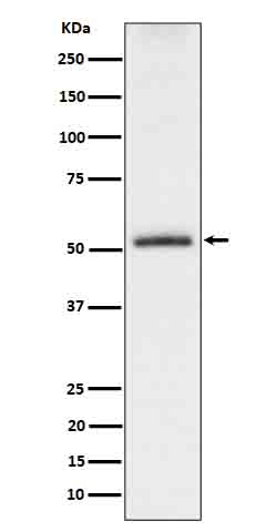 1 - Anti-Phospho-Tau (S198) Rabbit Monoclonal Antibody ABO16644