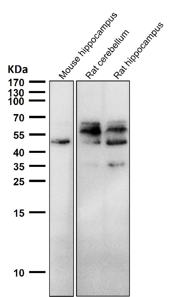 1 - Anti-Phospho-Tau (S198) Rabbit Monoclonal Antibody ABO16644