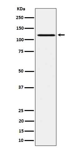 1 - Anti-Phospho-JAK1 (Y1034 + Y1035) Rabbit Monoclonal Antibody ABO16645