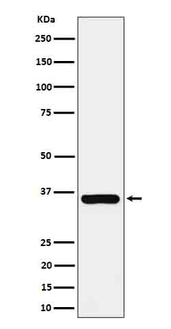 1 - Anti-Gamma glutamyl hydrolase Rabbit Monoclonal Antibody ABO16646